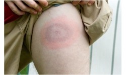 Mleczko repelent Mugga 50% DEET 50 ml