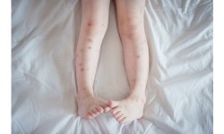 Mleczko repelent Mugga 50% DEET 50 ml