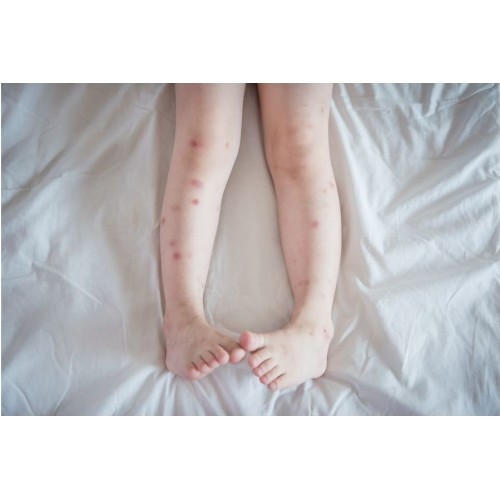 Repelent Mugga 50% DEET, 50 ml